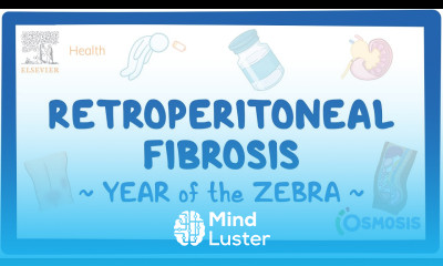 Retroperitoneal fibrosis Year of the Zebra