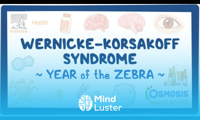 Wernicke Korsakoff Syndrome Year of the Zebra