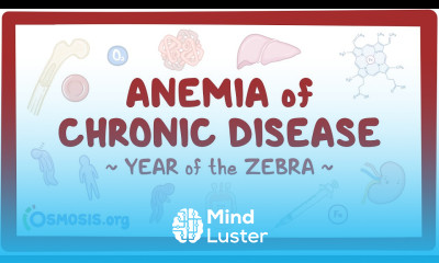Anemia of chronic disease Year of the Zebra