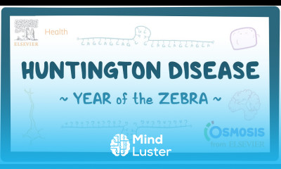 Huntington disease Year of the Zebra