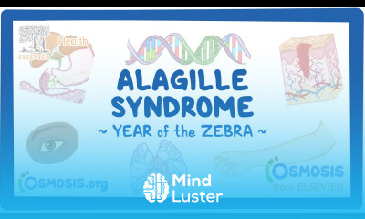 Alagille syndrome NORD Year of the Zebra