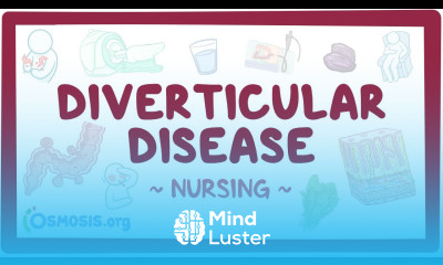 Diverticular disease Clinical Nursing Care