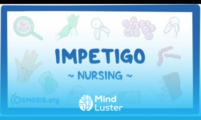 Impetigo Clinical Nursing Care