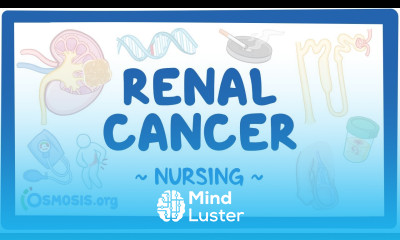 Renal Cancer Clinical Nursing Care