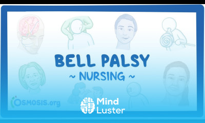 Bell Palsy Clinical Nursing Care