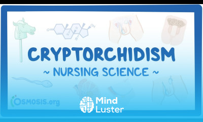 Cryptorchidism Clinical Nursing Care