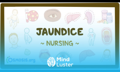 Jaundice Clinical Nursing Care