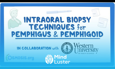 Intraoral Biopsy Techniques for Pemphigus Pemphigoid in Collaboration w Western University