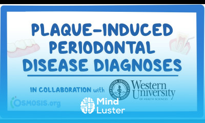 Plaque induced Periodontal Disease Diagnosis in Collaboration w Western University