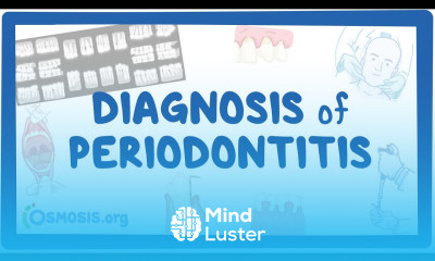 Diagnosis of Periodontitis