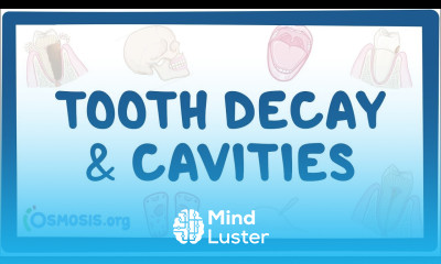 Tooth decay and cavities causes symptoms diagnosis treatment pathology