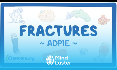 Fractures Nursing Process