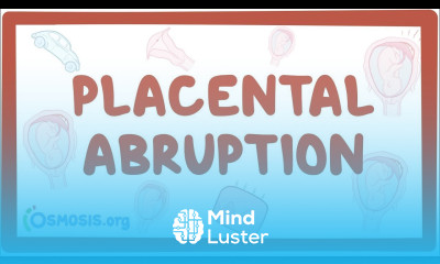 Placental abruption causes symptoms diagnosis treatment pathology