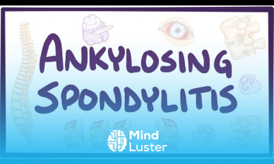Ankylosing spondylitis causes symptoms diagnosis treatment pathology