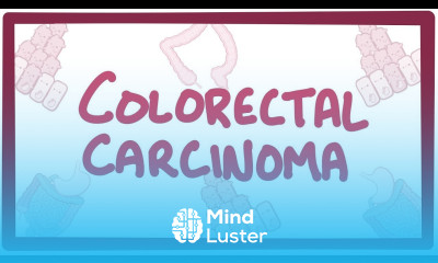 Colorectal carcinoma causes symptoms diagnosis treatment pathology