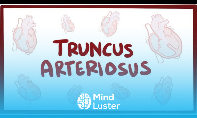 Truncus arteriosus TA causes symptoms diagnosis treatment pathology