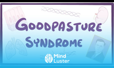 Goodpasture syndrome causes symptoms diagnosis treatment pathology