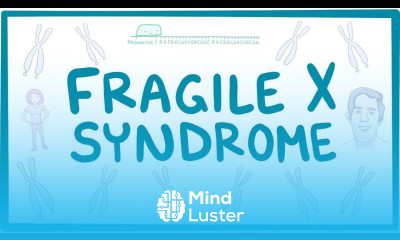 Fragile X Syndrome causes symptoms diagnosis treatment pathology