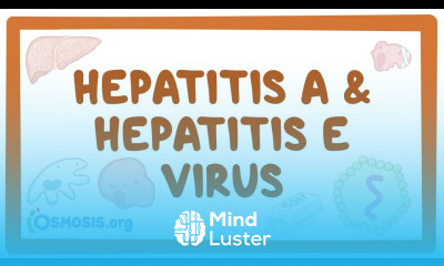 Hepatitis A and hepatitis E virus causes symptoms diagnosis treatment pathology