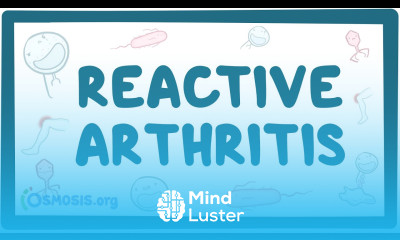 Reactive arthritis causes symptoms diagnosis treatment pathology