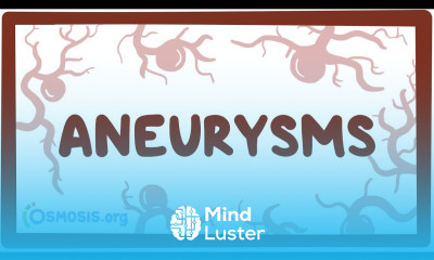 Aneurysms causes symptoms diagnosis treatment pathology