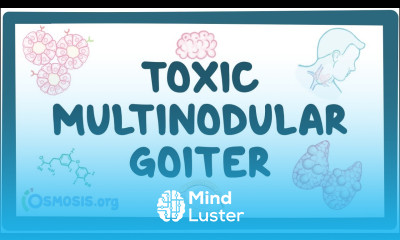 Toxic multinodular goiter causes symptoms diagnosis treatment pathology