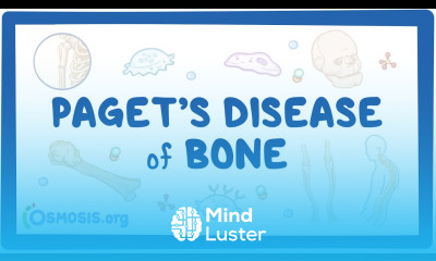 Paget disease of bone