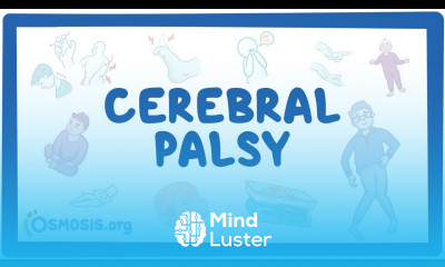 Cerebral palsy CP causes symptoms diagnosis treatment pathology