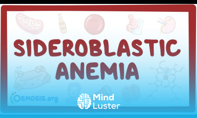Sideroblastic anemia causes symptoms diagnosis treatment pathology