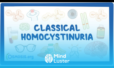 NORD Classical Homocystinuria