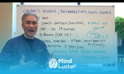 Crohn s Disease and Inflammatory Bowel Disease Real Case Study