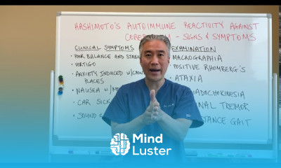 Hashimoto s Autoimmune Reactivity Against Cerebellum Brain Signs and Symptoms Dizzness Tremor