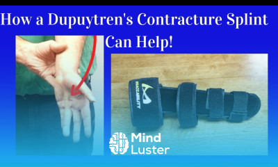 How a Dupuytren s Contracture Splint Helps