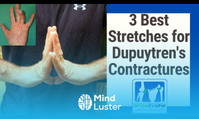 3 Best Stretches for Dupuytren s Contractures
