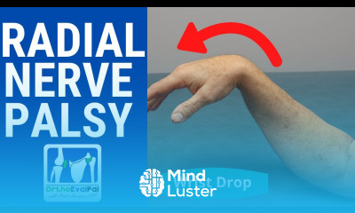 Radial Nerve Palsy Wrist Drop Evaluation