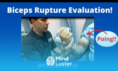 Biceps Rupture Evaluation Video long head biceps tear