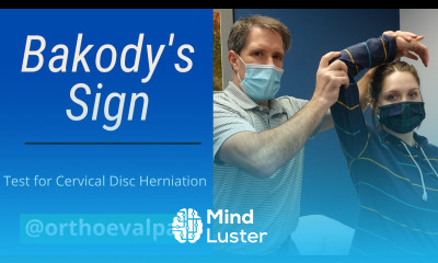 Bakody s Sign Test Shoulder Abduction Sign