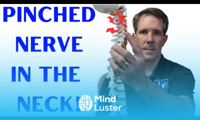 7 Signs and Symptoms of a Pinched Nerve in the Neck