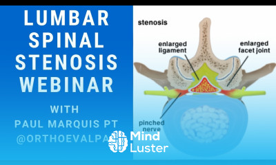 Lumbar Spinal Stenosis with Ortho Eval Pal
