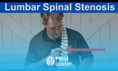 What is Lumbar Spinal Stenosis