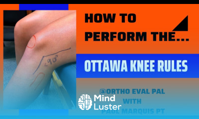 Ottawa Knee Rules To x ray or not to x ray