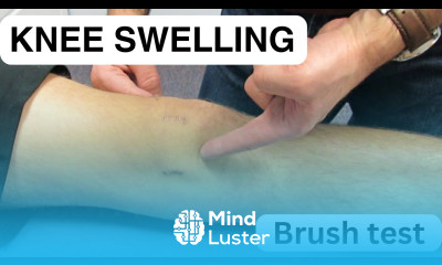 Knee Swelling The Brush Test