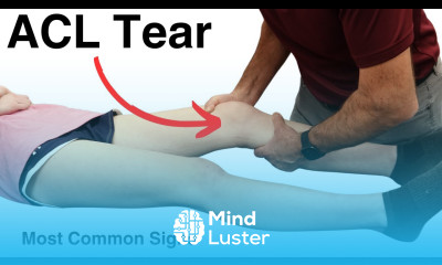 Learn Signs Of An ACL Tear What You Need To Know - Mind Luster