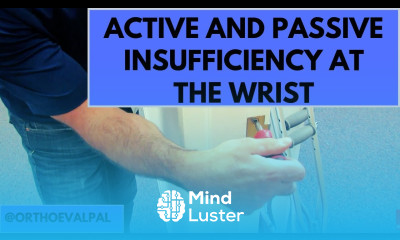 Active Passive Insufficiency Demo Hand and Wrist