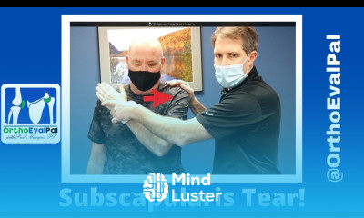 Subscapularis Rotator Cuff Tear