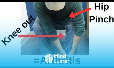 Classic Sign of Hip Arthritis This is the SIMPLEST test to identify it