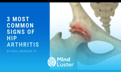 3 Most Common Signs of Hip Arthritis