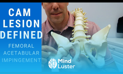 CAM Lesions Explained