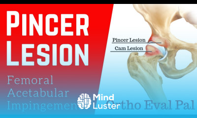 Pincer lesion Explained by Paul at Ortho Eval Pal