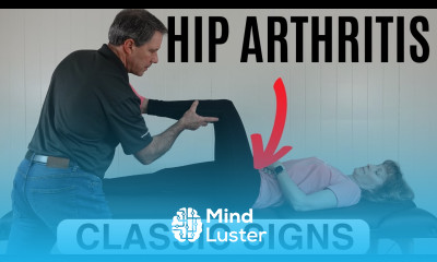 Classic Signs of Hip Arthritis